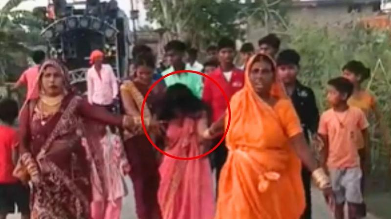 Girlfriend Threw Acid On Groom In Ballia Uttar Pradesh