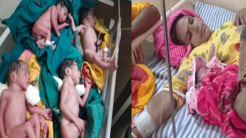 Woman gave birth to 4 children after 4 years of marriage, delivered in 8 months