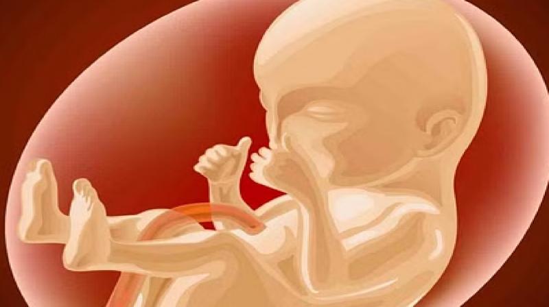 Uttarakhand News: Fetus found in the stomach of a 7 month old baby