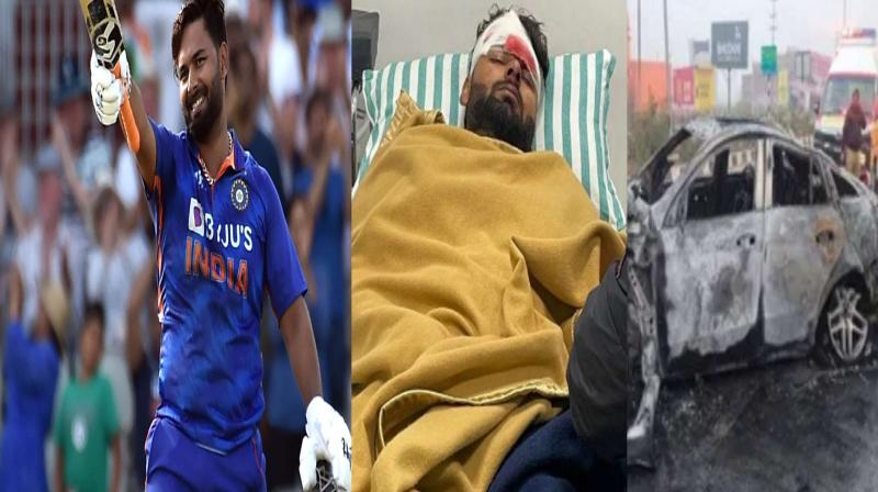 Rishabh Pant Car Accident: Indian cricket team's wicketkeeper Rishabh Pant injured in road accident, injuries ..