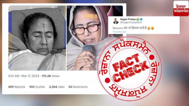 Mamta Banerjee is not pretending to be injured, viral pictures are related to different incidents - Fact Check report