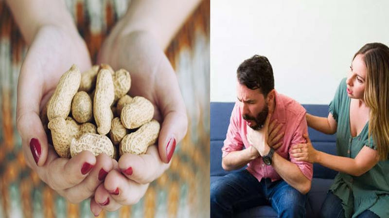 Consumption of peanuts becomes poison! Know which people should not consume 