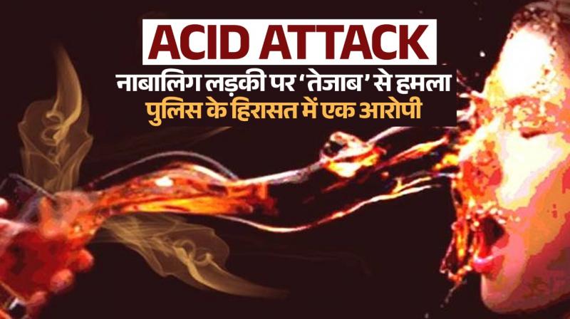 ACID ATTACK: Acid attack on a minor girl in West Delhi