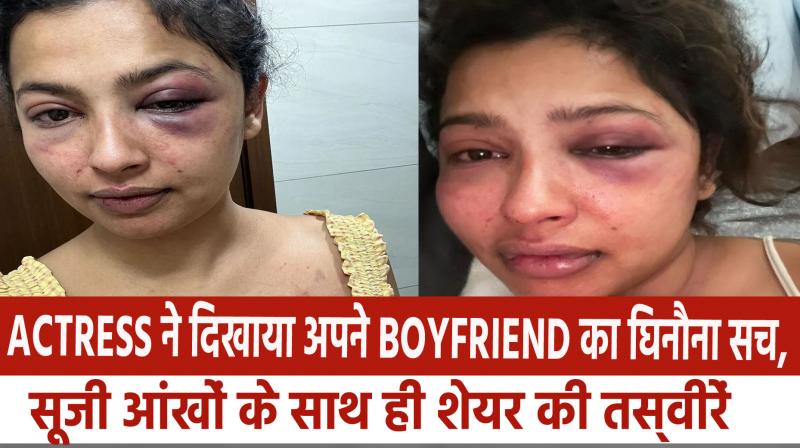 The actress showed the disgusting truth of her boyfriend, shared pictures with swollen eyes