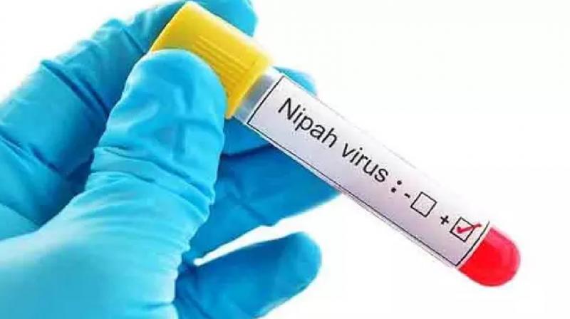 Death of 14 year old boy infected with Nipah virus news in hindi