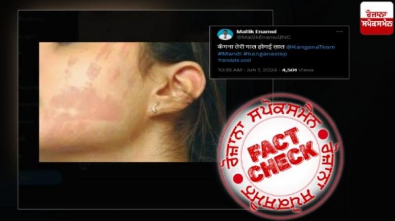 Old image from Baygon Slap advertisement viral as Kangana Face Slap marked by CISF Officer